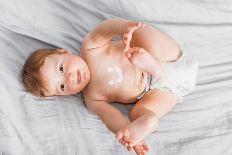 Diaper Rash vs Yeast: How to Tell the Difference